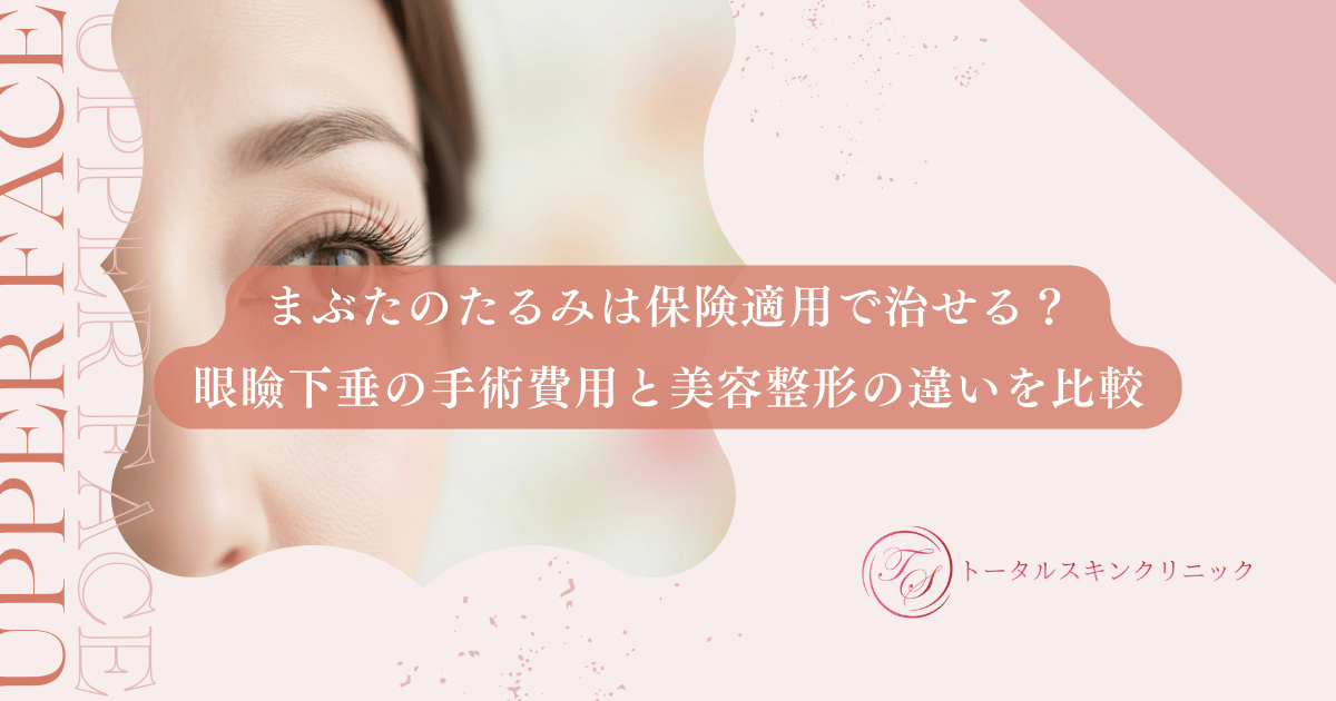 まぶたのたるみは保険適用で治せる?眼瞼下垂の手術費用と美容整形の違いを比較