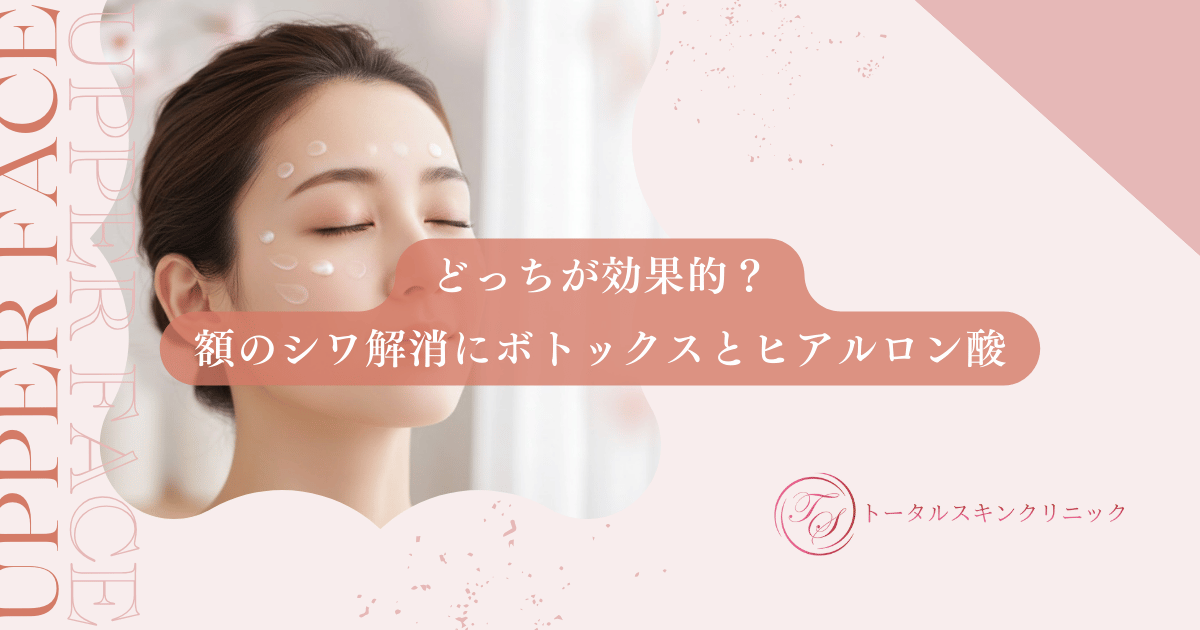 どっちが効果的？額（おでこ）のシワ解消にボトックスとヒアルロン酸を使い分ける基準