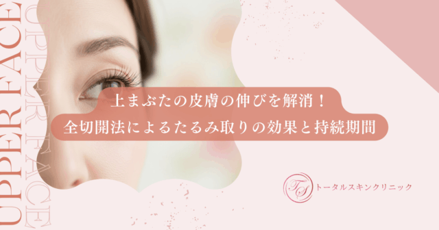 上まぶたの皮膚の伸びを解消！全切開法によるたるみ取りの効果と持続期間