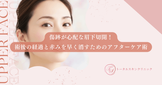 傷跡が心配な眉下切開！術後の経過と赤みを早く消すためのアフターケア術