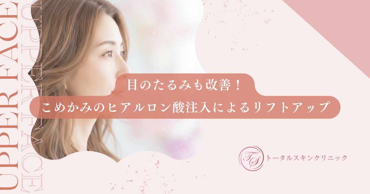 目のたるみも改善!こめかみのヒアルロン酸注入によるリフトアップ効果の仕組み
