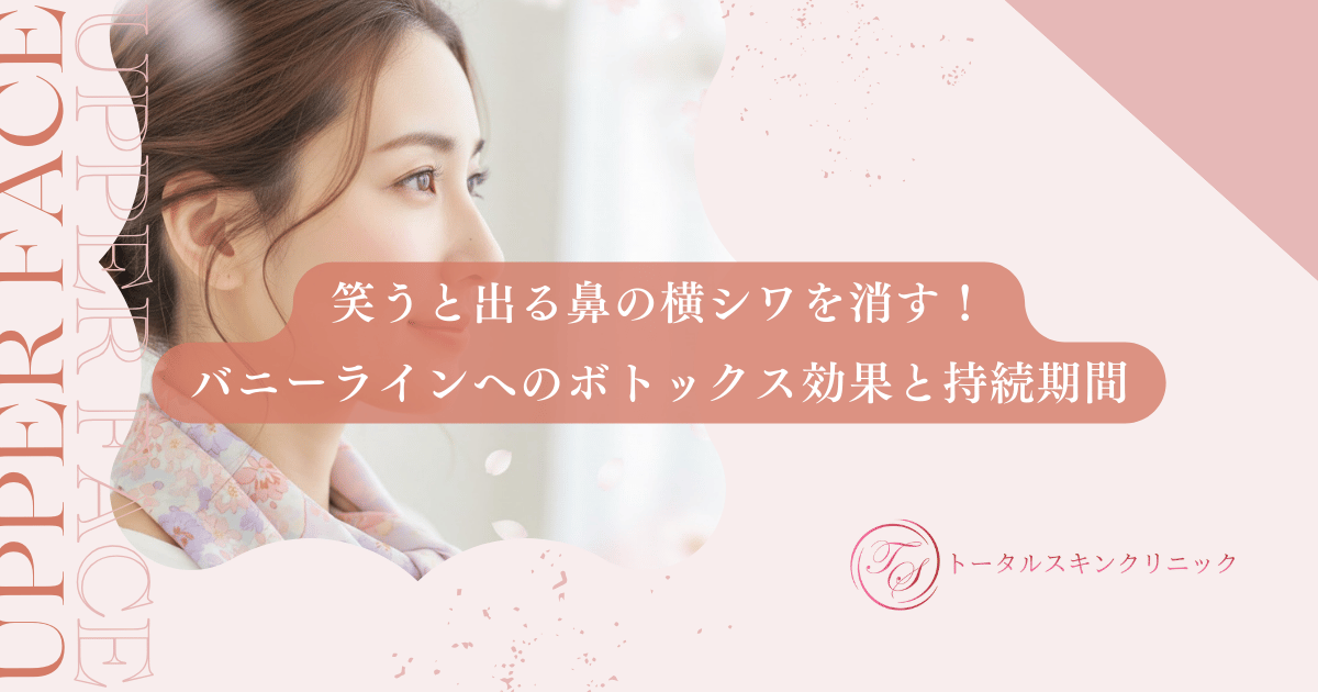 笑うと出る鼻の横シワを消す！バニーラインへのボトックス効果と持続期間
