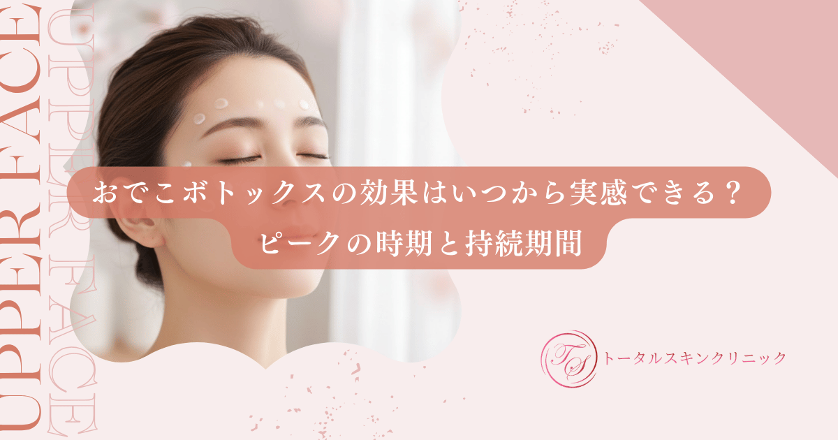 おでこボトックスの効果はいつから実感できる？ピークの時期と持続期間